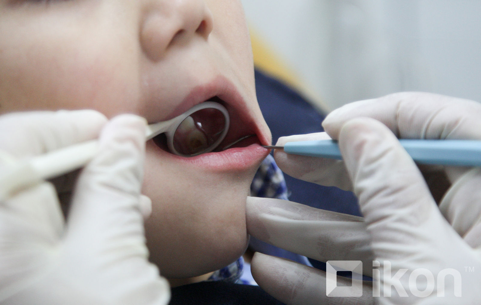 Энэ оны аравдугаар сарын 1-нээс өмнө цэцэрлэг, сургуулийн нийт 270,689 хүүхдийг эрт илрүүлэгт хамруулна