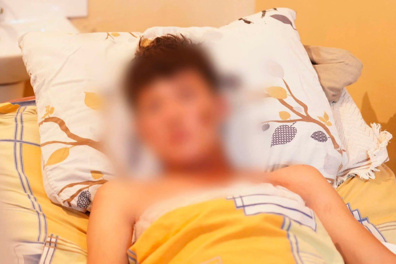 Чудо в Ноокене. 16-летний подросток выжил после прямого удара молнии