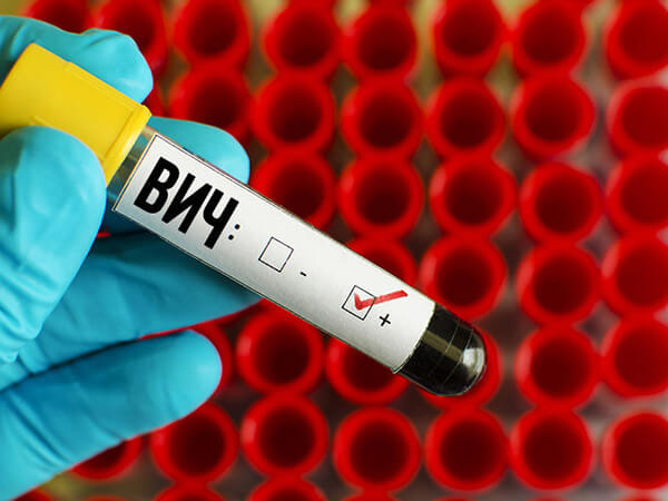 Об угрозе нового всплеска эпидемии ВИЧ предупредили в ООН