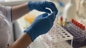 Санитарно-карантинные пункты в Казахстане перешли на усиленный режим из-за хантавируса